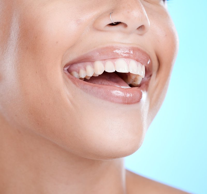Can dental bonding or veneers help with severe tooth discoloration?