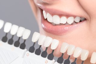 4_Attributes_of_Dental_Implants_You_Should_Know.jpg