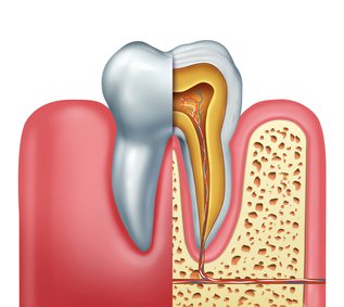 Does-Your-Dentist-Recommend-Endodontic-Therapy.jpg