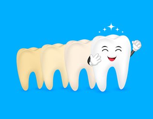 Top_4_Ways_Teeth_Whitening_Will_Make_Life_Better.jpg
