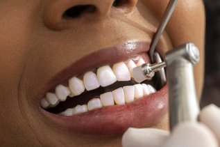Dental hygienist performing initial oral examination before cleaning
