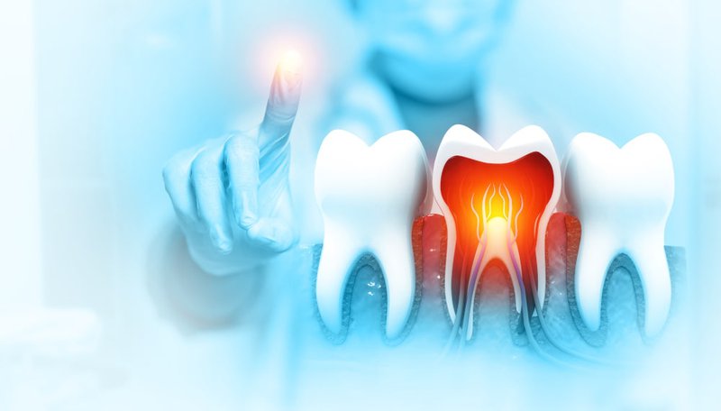 Step-by-step process of root canal treatment in dental clinic